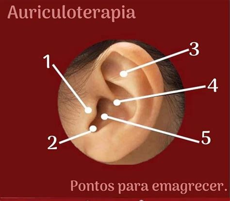 Ansiedade Auriculoterapia Pontos Para Emagrecer - Viviane Carvalho - 💎Auriculoterapia para emagrecer funciona? Funciona ...
