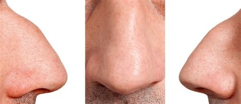 196 Aquiline Nose Images, Stock Photos, 3D objects, & Vectors ...