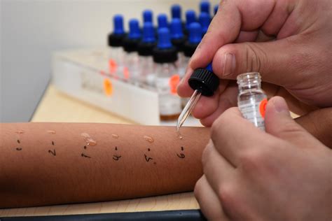 El Servicio de Alergia e Inmunología Clínica del HUP realiza estudios