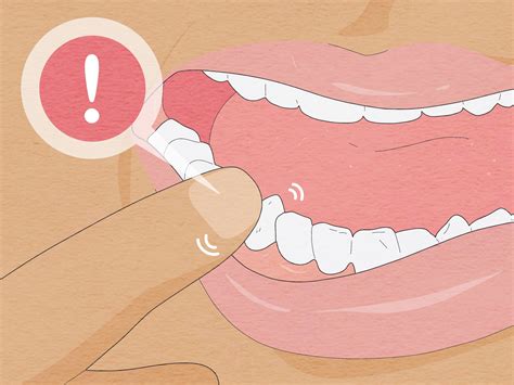 12 Ways to Pull a Loose Tooth at Home - wikiHow