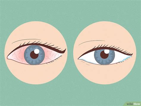 how to know if contact is still in eye