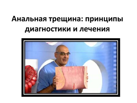 Анальная трещина: принципы диагностики и лечения - презентация онлайн