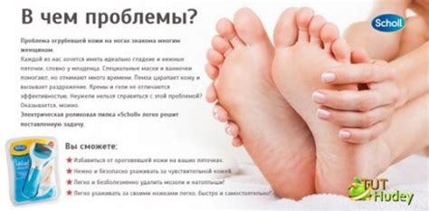 Как пользоваться пилкой Шолль для пяток: отзывы, цена, советы по ...