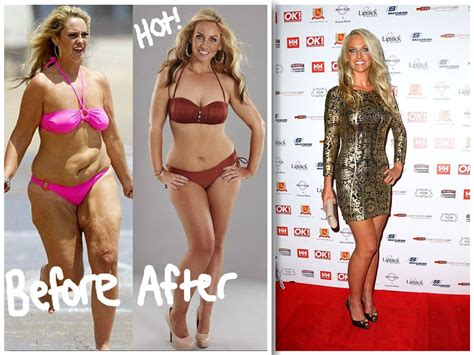 Kirsten Vangsness Weight Loss Surgery – Blog Dandk