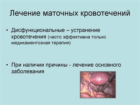 Маточные кровотечения - презентация онлайн