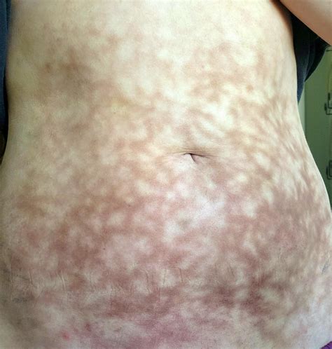 Tell me you lay on a heating pad every day without telling me you lay