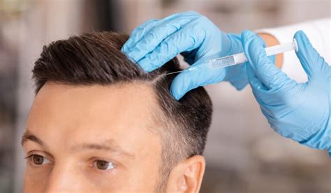 Non Surgical Hair Transplant – Stitch less and Painless Hair Treatment ...
