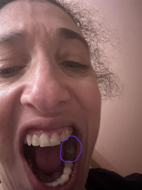 Tooth looks like it broke . No pain . Just looks funny : r/askdentists