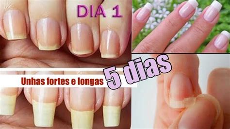 A Unha Cresce Quanto Por Dia - COMO FAZER A UNHA CRESCER EM 5 DIAS – Artes em Geral