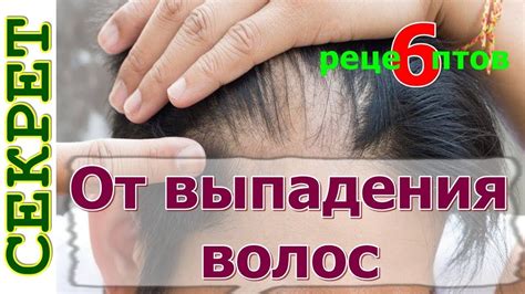 Народные средства от выпадения волос - YouTube