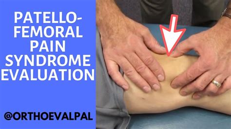 Patellofemoral Pain Syndrome Evaluation and Treatment - YouTube