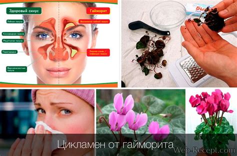Как сделать капли из цикламена от гайморита - Web-Recept.com