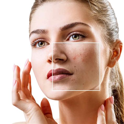 how to get rid of redness on face 4