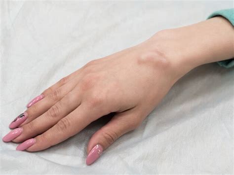 bilder zyste gratis vektoren fotos und psds