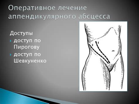 Осложнения острого аппендицита - презентация онлайн