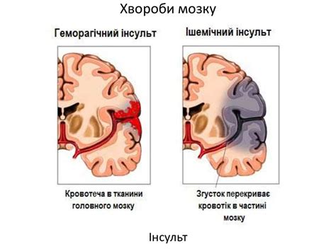Будова та функції кінцевого мозку - презентация онлайн