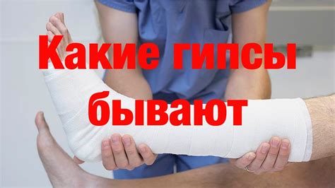 Какие гипсовые повязки бывают - YouTube