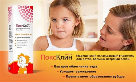 Вітрянка (вітряна віспа) у дітей