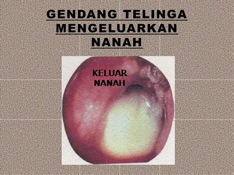 PPT - ALAT INDERA MANUSIA PowerPoint Presentation, free download - ID ...