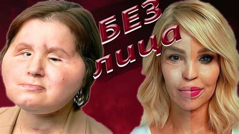 Обожжённая любовью / Она выстрелила себе в лицо. История Кэти Пайпер и ...