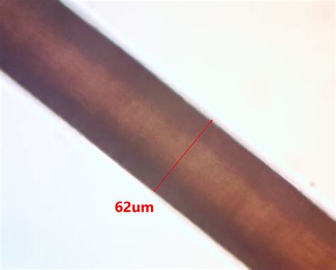 Human Hair – Under Microscope