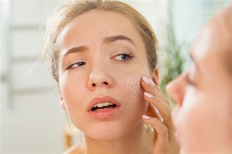 prevent dry itchy skin  winter digestley