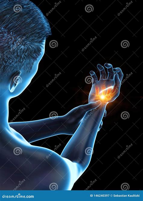 A painful wrist stock illustration. Illustration of fingers - 146240397