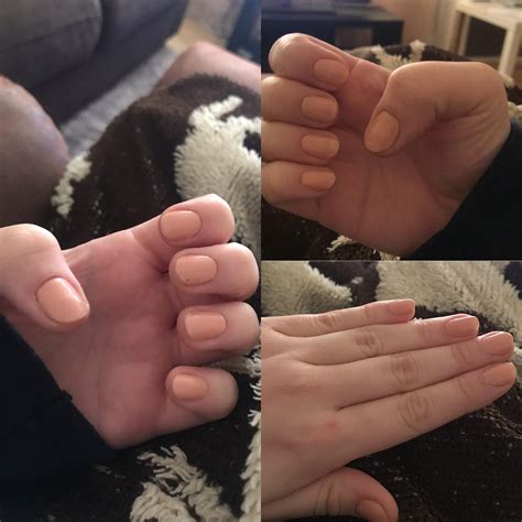 Have not bitten my nails for around 4 weeks and I’ve been filing