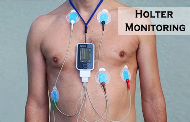 implantable loop recorder procedure - peoplemote