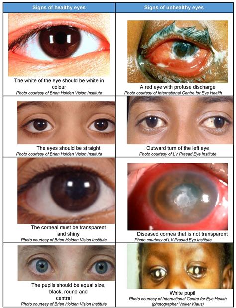 Eye Health Chart