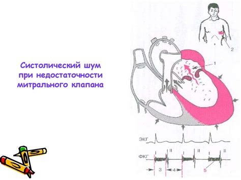 Аускультация сердца: тоны и шумы - презентация онлайн