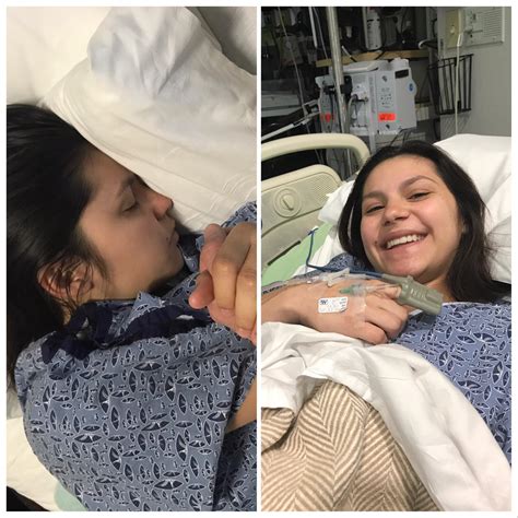 Before and after epidural : r/BabyBumps
