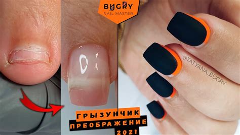 ПРЕОБРАЖЕНИЕ НОГТЕЙ ГРЫЗУНА ЧАСТЬ 3 / НОГОТЬ ПРИРОСТАЕТ / Татьяна ...