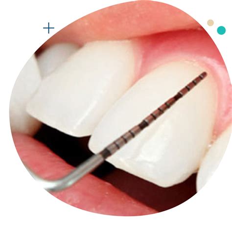 paradontologia studio dentistico merlini
