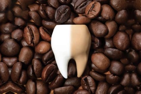 brown  stained teeth