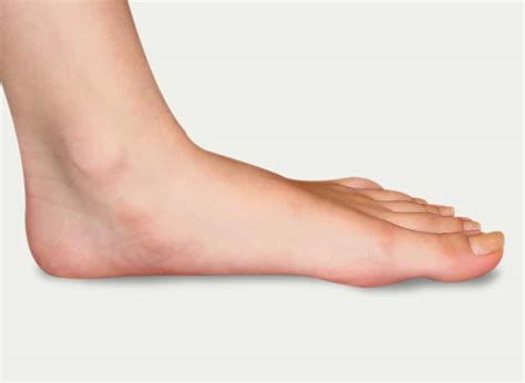 flat feet davenport house clinic