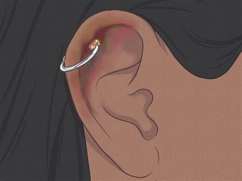 10 Ways to Heal Cartilage Piercing Bumps Faster