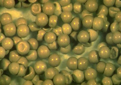 Getting the most out of Artemia in shrimp aquaculture | The Fish Site