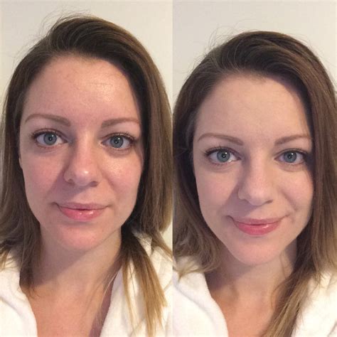 Arthurwears: bareMinerals Blemish Remedy Foundation | review | Before ...