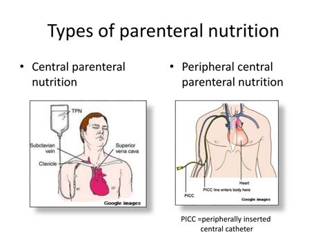 basics  enteral  parenteral nutrition powerpoint