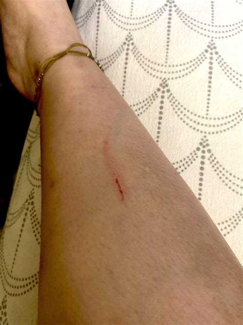 i got scratched :( : r/ParanormalEncounters