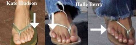 celebrities   physical defects  pics izismilecom