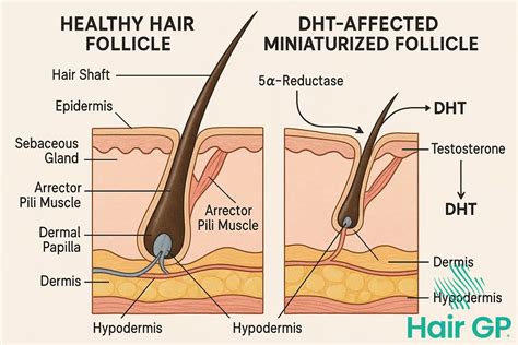 natural hair loss remedies  palmetto benefits hair gp