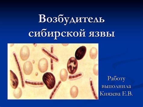 Возбудитель сибирской язвы - online presentation