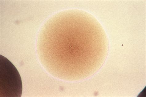 Free picture: colony, neisseria, gonorrhoeae, bacteria