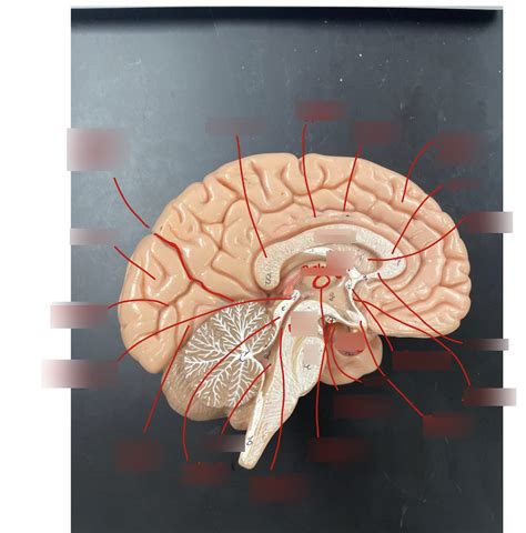 lab models diagram quizlet