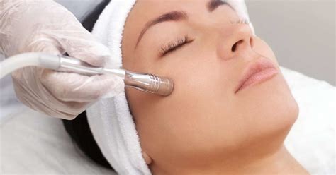 Microdermabrasion: Benefits, uses, procedure, and risks