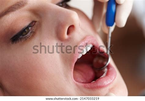 patient open mouth images stock  vectors shutterstock