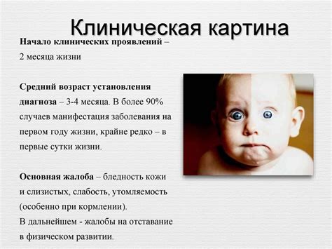 Анемия Даймонда -Блекфена. Синдром Швахмана - Даймонда - презентация онлайн