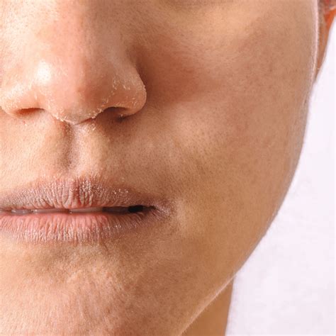 kandungan berikut ampuh mengatasi kulit kering erhastory